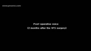 Voice Feminization Surgery Result of various patients at Yeson Voice Center [upl. by Hepsiba260]