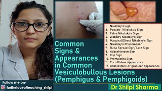 Signs in common Vesiculobullous Lesions Pemphigus amp Pemphigoids [upl. by Gula]