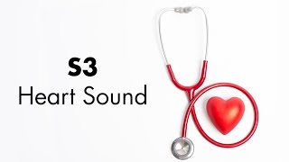 S3 Heart Sound  MEDZCOOL [upl. by Zelig]