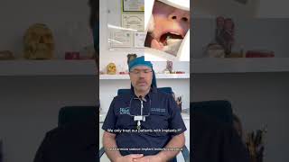 Dental implantlar nedir Çok zor bir süreçmi [upl. by Joris]