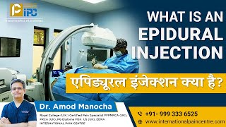 Epidural Injection amp Nerve Root Block for Sciatica Pain Management  Dr Amod Manocha [upl. by Ativla]