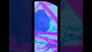 Rhizopus sp under microscope  Microbiology education shorts [upl. by Rus]