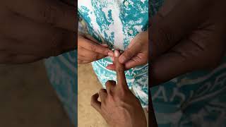 satisfying toenailfungus ingrowntoenailsurgery pedicure toenails nails [upl. by Vada]