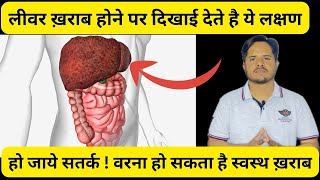 Liver Kharab Hone Ke LakshanIn HindiLiver Damage Symptoms and Sign Explained [upl. by Gredel]