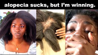 How I beat alopecia  4C Natural Hair [upl. by Selrahc416]