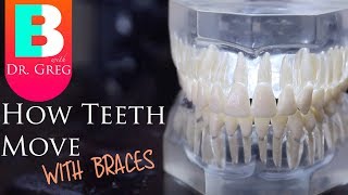 BRACES EXPLAINED How Teeth Move  Braces Work [upl. by Sokul]