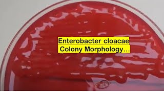 Enterobacter cloacae growth on CLED agar of Urine Culture [upl. by Azial]