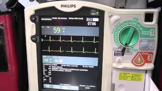 Philips ECG Management Systems  Telemedicine in the Baleares [upl. by Akceber]