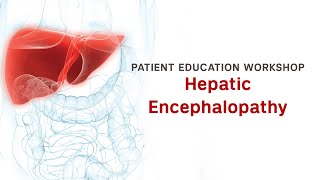 Workshop  Hepatic Encephalopathy [upl. by Neale693]