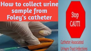 How to collect urine sample from Foleys catheterSample collection procedure2023nidhicreation2012 [upl. by Strohben]