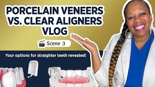 Porcelain Veneers vs Clear Aligners Vlog What Are Porcelain Veneers [upl. by Feinberg]