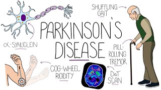 Understanding Parkinsons Disease Including Direct and Indirect Pathways [upl. by Airet]