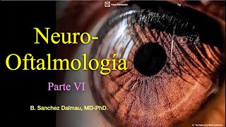 Neuroftalmología Parte VI [upl. by Auberta164]