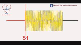 Soplo de la insuficiencia mitral [upl. by Tabitha]