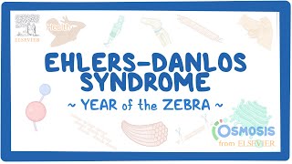 EhlersDanlos syndrome Year of the Zebra [upl. by Aspia]