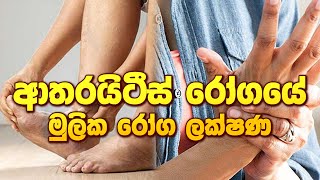 ආතරයිටීස් රෝගයේ මුලික රෝග ලක්ෂණ ayurveda arthritis arthritiscure arthritistreatment [upl. by Nibur]