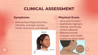 Polycystic Ovary Syndrome PCOS [upl. by Harbot]