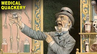 Bizarre Medical Practices From History [upl. by Godfrey]