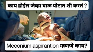 Meconium Aspiration Syndrome explained in Marathi  बाळाने पोटात शी केली [upl. by Androw]