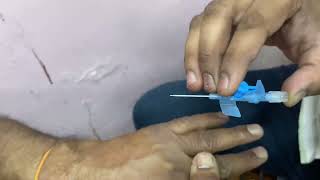 Intravenous iv Cannulation  ivcannulation cannula subscribe mbbs doctor neet ivtherapy [upl. by Murray124]