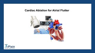 Cardiac Ablation for Atrial Flutter [upl. by Doubler]