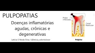 Pulpopatias  Doenças inflamatórias agudas crônicas e degenerativas da polpa [upl. by Rollecnahc833]