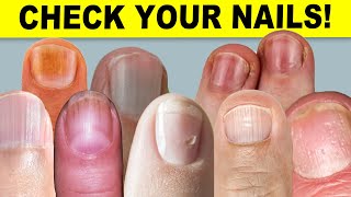 9 Things Your Nails Can Tell You About Your Health [upl. by Dawna218]