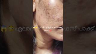 😱ഏലാദി ചൂർണ്ണം ഫേസ് പാക്ക് Day 7 facepackforacne facepackforglowingskin facepackforteenagers [upl. by Frederique]