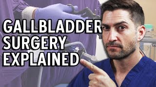 Gallbladder Surgery Explained  Complications and Recovery [upl. by Anivel]