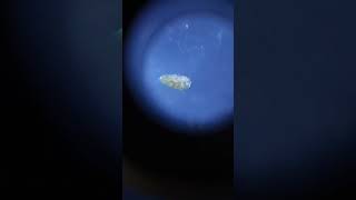 Дафния под микроскопом 4 Water flea in the microscope 4 aquarium [upl. by Hooke]