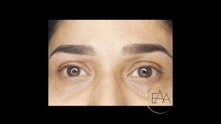 Hyper realistic eyebrows by Dr Sajesh microbladedbrows browtattoo beauty skincare eyebrows [upl. by Leicam]