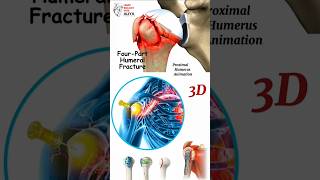 Proximal Humerus Animation  humerus factures animation  humerus animation  BiologywithAliya [upl. by Myron]