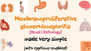 Membranoproliferative glomerulonephritis  MPGN  Renal system  Pathology  Med Vids made simple [upl. by Nehttam315]