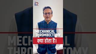 मैकेनिकल थ्रॉम्बेक्टॉमी Thrombectomy Surgeon in Indore DVT Mechanical Thrombectomy dralokkudiya [upl. by Sufur]