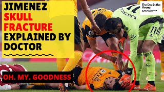 RAUL JIMENEZ SKULL FRACTURE  Doctor explains return from head injury after clash with David Luiz [upl. by Lednek4]