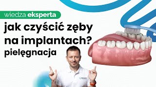 JAK DBAĆ O HIGIENĘ JAMY USTNEJ KIEDY POSIADASZ IMPLANTY IRYGATOR [upl. by Hayidan]