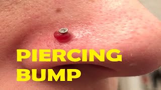 how to get rid of a big nose piercing bump [upl. by Saxet]