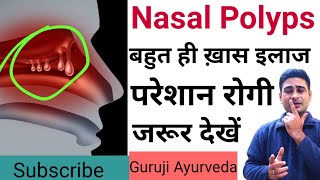 nasal polyps ka desi ilaj  nasal polyps ayurvedic treatment [upl. by Booze]