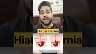 The Complete Guide to Hiatus Hernia What You Need to Know [upl. by Tebor263]