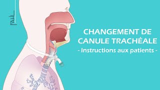 Changement de canule trachéale pour les patients  Animation  Fahl MedizintechnikVertrieb GmbH [upl. by Ylrebma]