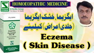 PTK 50 Graphites Pentarkan  DrWillmar Schwabe Germany  Homoeopathic Medicine  Urdu Hindi [upl. by Kerin]