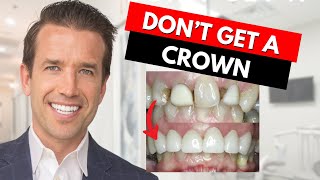 Watch this before getting a Dental Crown [upl. by Skiest119]