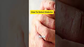 How to Detect Diabetes [upl. by Helfant76]