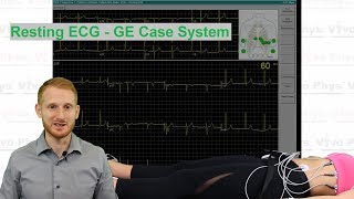 Resting ECG  GE Case System [upl. by Semmes463]