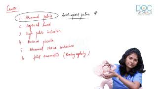 Session 3 Abnormal Labour  Occipitoposterior Position  Dr Vidya  OBG  NEET PG  DocTutorials [upl. by Atikim]