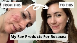 Rosacea Skincare Routine  These Products Changed My Life  Korean Skincare [upl. by Kory]