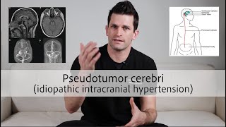 Pseudotumor cerebri idiopathic intracranial hypertension [upl. by Naujej393]