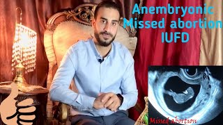 Level 3  Female pelvis  Obs  Emergency  Missed abortion and IUFD [upl. by Htial]