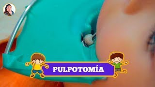 PULPOTOMÍA para NIÑOS 👦🏻  ODONTOPEDIATRÍA 😀  CLÍNICA DENTAL Hada 🧚🏻 [upl. by Oliva]