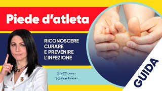 Piede d’atleta come riconoscere curare e prevenire l’infezione [upl. by Nowell]